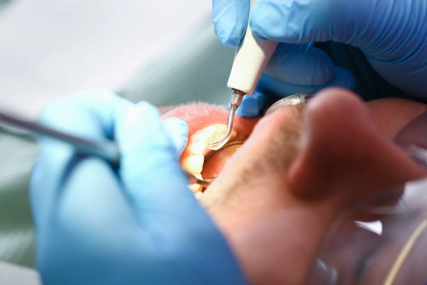 Best Emergency Dental Extractions in Pollock Pines, CA