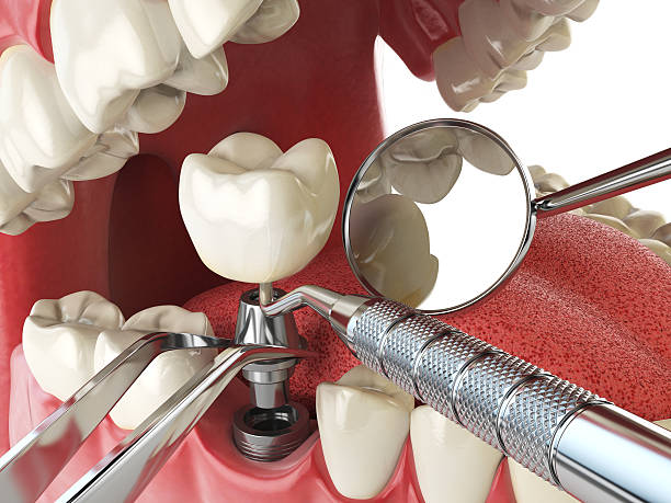 Best Broken or Cracked Tooth Emergency Dentist in Pollock Pines, CA