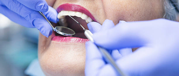 Best Emergency Dental Services for Seniors in Pollock Pines, CA