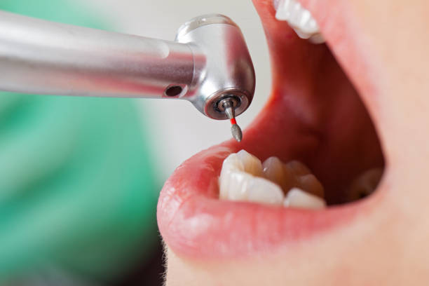 Best Weekend Emergency Dentist in Pollock Pines, CA